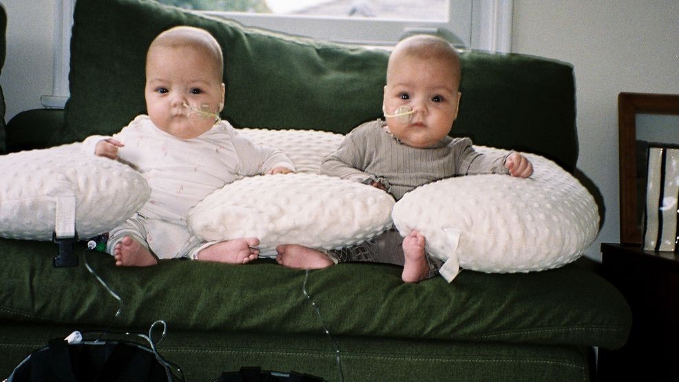 Image for story: 'Unimaginable' pain as twin babies battle cancer. Their clinical trial is under threat.