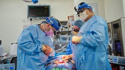 Image for story: Doctors transplant pig hearts into 2 brain-dead people as testing inches toward the living