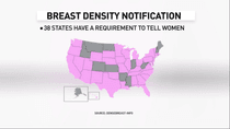 Image for story: FDA issues final rule on breast density notifications